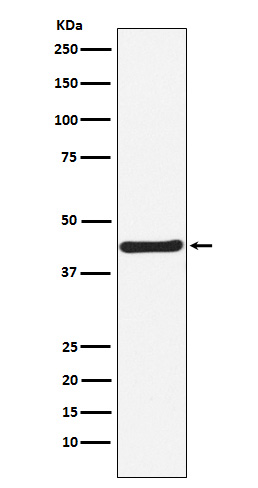 HOXA5 Rabbit mAb