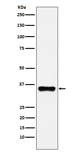 HOXA9 Rabbit mAb