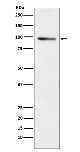 PDE4B Rabbit mAb