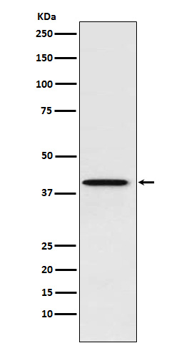 PCBP1 Rabbit mAb