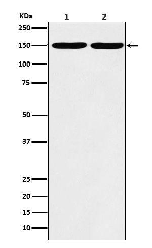 Collagen III Rabbit mAb