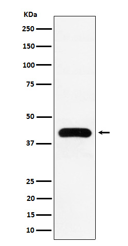 MVD Rabbit mAb