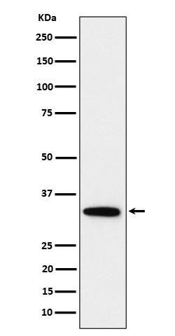 PPP6C Rabbit mAb