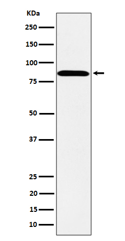 PPM1E Rabbit mAb