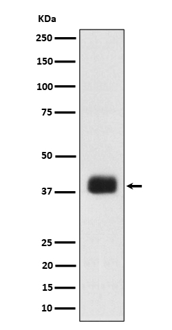 SR protein repeat Rabbit mAb