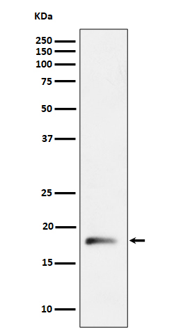 RPL26L1 Rabbit mAb