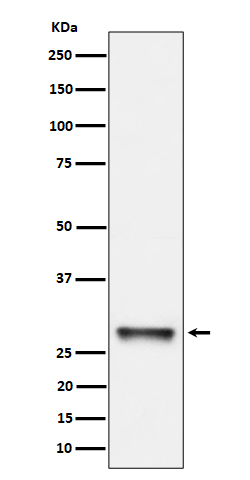 PNMT Rabbit mAb