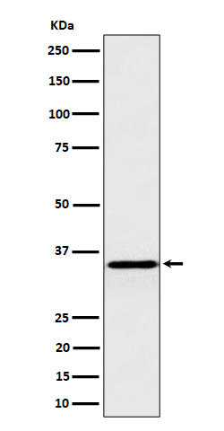 Pyrophosphatase 1 Rabbit mAb