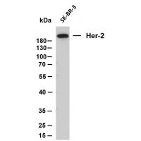 Her-2 mouse mAb(ABT008)