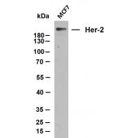 Her-2 mouse mAb(ABT008)