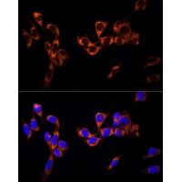 GPER1 Rabbit Polyclonal Antibody