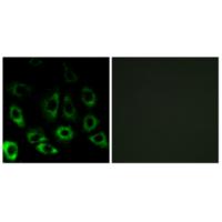 S2P Polyclonal Antibody