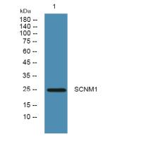 SCNM1 Polyclonal Antibody