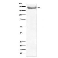 Neurofilament heavy polypeptide Rabbit mAb