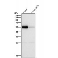 PEPD Rabbit mAb