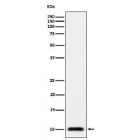 Ubiquitin 60S Ribosomal Protein L40 Rabbit mAb