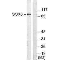 Sox-6 Polyclonal Antibody