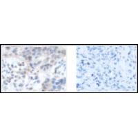 CAMTA1 Antibody