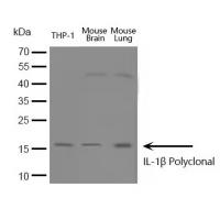 IL-1β Polyclonal Antibody