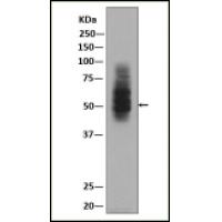 Glucose Transporter GLUT1 Rabbit mAb