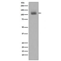 Phospho-JAK2(Y1007+Y1008) Rabbit mAb