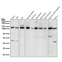 JAK2 Rabbit mAb