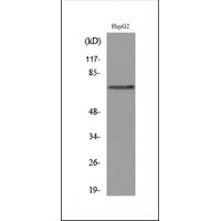 Glypican-3 Polyclonal Antibody