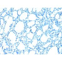 LSM11 Antibody