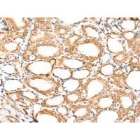 LSM11 Antibody