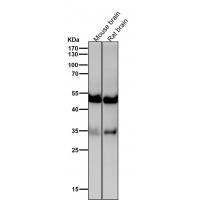 Activin A Receptor Type IB Rabbit mAb