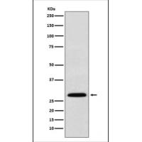 KGF Rabbit mAb