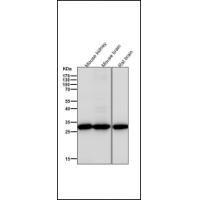 KGF Rabbit mAb