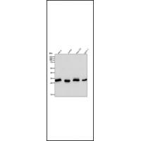 KGF Rabbit mAb