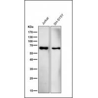 ACADVL/VLCAD Antibody