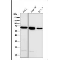 ACADVL/VLCAD Antibody