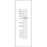 Phospho-PKC alpha (T497) Antibody