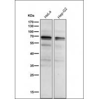 Phospho-PKC alpha (T497) Antibody