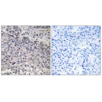 C1q-C Polyclonal Antibody