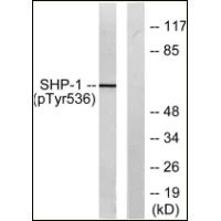 SHP-1(Phospho-Tyr536) Antibody