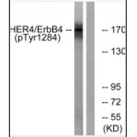 HER4 (Phospho-Tyr1284) Antibody