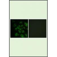 HER4 (Phospho-Tyr1284) Antibody