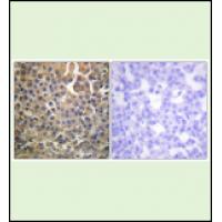 HER4 (Phospho-Tyr1284) Antibody