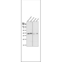 CCR2 Rabbit mAb