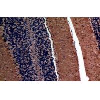 AFP Polyclonal Antibody