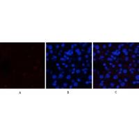 JAK1(Phospho-Tyr1022) Antibody