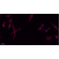 GLUT4 Rabbit Polyclonal Antibody