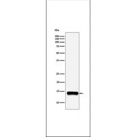 Secretory Phospholipase A2 Rabbit mAb