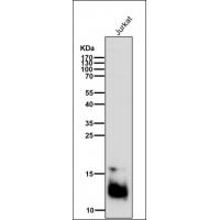 Secretory Phospholipase A2 Rabbit mAb