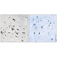 MRP-L52 Polyclonal Antibody