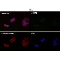 LC3B Rabbit mAb